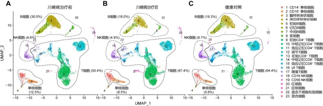 川崎病的免疫细胞“地图”