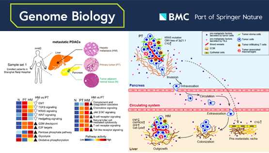李虹、李亦学研究组合作破译胰腺癌肝转移的分子特征